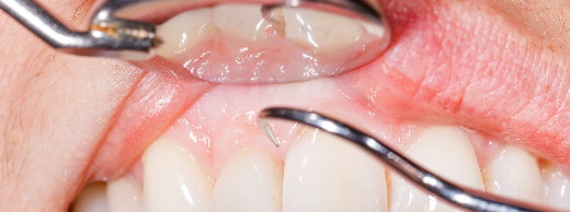 בדיקת שיניים
